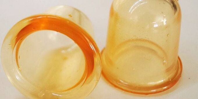 Cups for the treatment of prostatitis