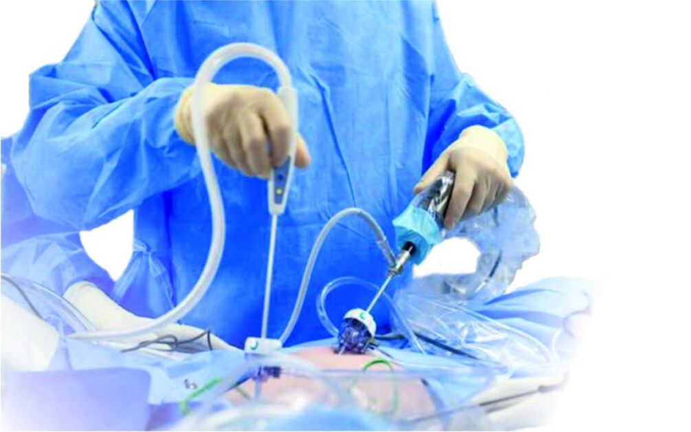 Operation